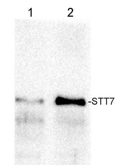 Western blot using anti-STT7 antibodies